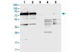 Western blot analysis of Lane 1: RT-4, Lane 2: U-251 MG, Lane 3: Human Plasma, Lane 4: Liver, Lane 5: Tonsil with SRP72 polyclonal antibody  at 1:250-1:500 dilution. (SRP72 anticorps)