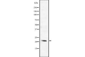 Western blot analysis of BCL2L10 expression in ; HepG2 cell lysate,The lane on the left is treated with the antigen-specific peptide.