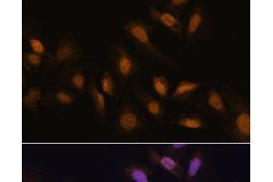Immunofluorescence analysis of U-2 OS cells using RBM39 Polyclonal Antibody at dilution of 1:100.