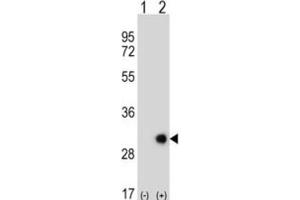 Western Blotting (WB) image for anti-Ethylmalonic Encephalopathy 1 (ETHE1) antibody (ABIN3002726)