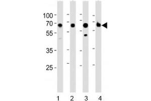 Western blot analysis of lysate from 1) human kidney, 2) mouse kidney, 3) mouse liver and 4) rat kidney tested with ACSM5 antibody at 1:1000. (ACSM5 anticorps  (AA 562-596))