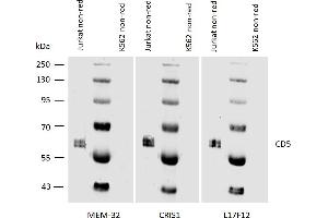Western blotting analysis of human CD5 using mouse monoclonal antibodies MEM-32, CRIS1, and L17F12 on laurylmaltoside lysates of Jurkat cells and of K562 cells (negative control) under non-reducing conditions. (CD5 anticorps)