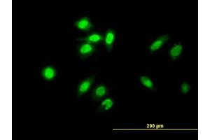 Immunofluorescence of monoclonal antibody to TESK2 on HeLa cell.