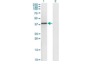 Western Blot analysis of DNAJB6 expression in transfected 293T cell line by DNAJB6 monoclonal antibody (M03), clone 1A5.