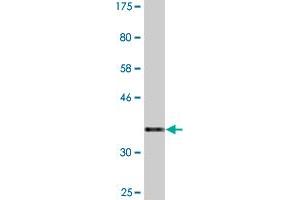 Western Blot detection against Immunogen (36. (PATZ1 anticorps  (AA 260-358))