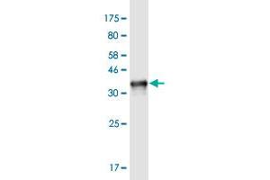Western Blot detection against Immunogen (33. (NOMO3 anticorps  (AA 966-1033))