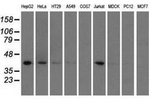 Western blot analysis of extracts (35 µg) from 9 different cell lines by using anti-HIBCH monoclonal antibody. (HIBCH anticorps)