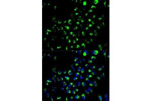 Immunofluorescence analysis of A549 cells using AK4 antibody. (AK4 anticorps  (AA 1-223))