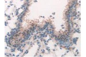 IHC-P analysis of Mouse Lung Tissue, with DAB staining. (MAPK7 anticorps  (AA 185-419))
