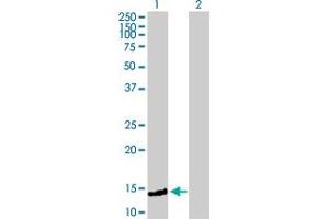 Western Blot analysis of FXC1 expression in transfected 293T cell line by FXC1 MaxPab polyclonal antibody. (TIMM10B anticorps  (AA 1-103))