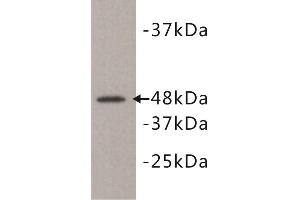 Western Blotting (WB) image for anti-Kinase D-Interacting Substrate, 220kDa (KIDINS220) antibody (ABIN1854930) (KIDINS220 anticorps)