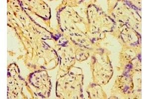 Immunohistochemistry of paraffin-embedded human placenta tissue using ABIN7145048 at dilution of 1:100