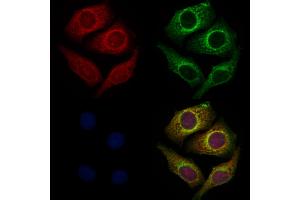 ABIN6261132 and ABIN6272283 staining Hela cells by IF/ICC. (CYB561D1 anticorps  (C-Term))