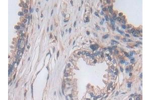 Detection of PCSK5 in Human Prostate Tissue using Polyclonal Antibody to Proprotein Convertase Subtilisin/Kexin Type 5 (PCSK5)
