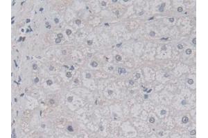 Detection of LACTb in Human Liver Tissue using Polyclonal Antibody to Lactamase Beta (LACTb)