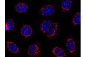 Immunofluorescence staining of HeLa cells using STIM1 monoclonal antibody, clone CDN3H4 . (STIM1 anticorps  (C-Term))