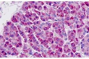 Human Pancreas: Formalin-Fixed, Paraffin-Embedded (FFPE) (PAK6 anticorps  (AA 268-297))