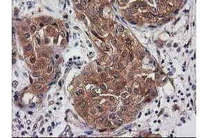 Image no. 15 for anti-Destrin (Actin Depolymerizing Factor) (DSTN) antibody (ABIN1497908)