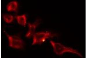 ABIN6278213 staining Hela by IF/ICC.