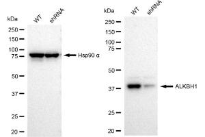 Western blotting analysis using ALKBH1 antibody (ABIN7797579).
