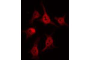 ABIN6274592 staining COLO205 by IF/ICC.