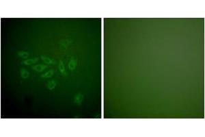 Immunofluorescence (IF) image for anti-Fragile Histidine Triad (FHIT) (AA 81-130) antibody (ABIN2889196)