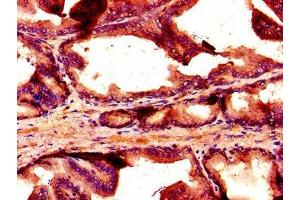 Immunohistochemistry of paraffin-embedded human prostate tissue using ABIN7161004 at dilution of 1:100 (NOX1 anticorps  (AA 418-564))