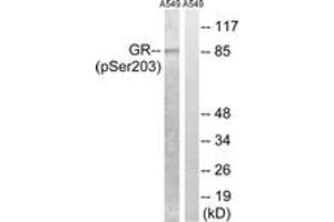 Western blot analysis of extracts from A549 cells treated with dexamethason 10nM 1h, using GR (Phospho-Ser203) Antibody. (GR (AA 171-220), (pSer203) anticorps)