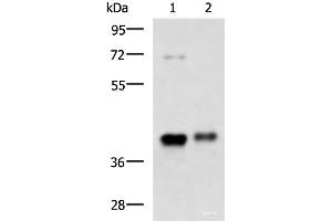 Western blot analysis of Mouse brain tissue and Human fetal brain tissue lysates using GNAZ Polyclonal Antibody at dilution of 1:1300 (GNaZ anticorps)