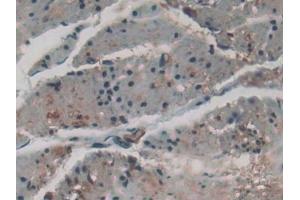 Detection of FOXO1 in Human Esophagus Tissue using Polyclonal Antibody to Forkhead Box Protein O1 (FOXO1)