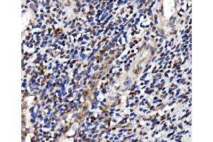 IHC analysis of TBP-1/PSMC3 using anti-TBP-1/PSMC3 antibody (ABIN7599393).