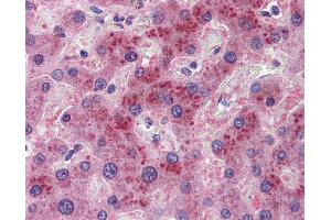 Immunohistochemistry (IHC) image for anti-Fibroblast Growth Factor 21 (FGF21) (N-Term) antibody (ABIN2786170)