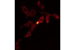 ABIN6278574 staining HeLa cells by IF/ICC. (GIT1 anticorps  (Internal Region))