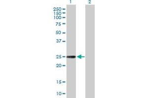 Western Blot analysis of NXNL1 expression in transfected 293T cell line by NXNL1 MaxPab polyclonal antibody. (NXNL1 anticorps  (AA 1-212))