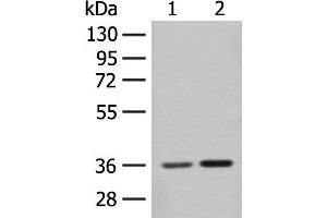 Western blot analysis of Mouse brain tissue and Rat brain tissue lysates using SLC25A27 Polyclonal Antibody at dilution of 1:350 (SLC25A27 anticorps)