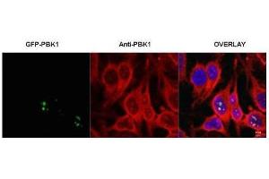 anti-Ribosomal L1 Domain Containing 1 (RSL1D1) antibody