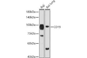 Western blot analysis of extracts of various cell lines, using CD19 antibody (ABIN3023663, ABIN3023664, ABIN3023665 and ABIN6219683) at 1:1000 dilution.