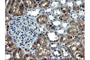 Image no. 5 for anti-Cytidine Monophosphate (UMP-CMP) Kinase 1, Cytosolic (CMPK1) antibody (ABIN1497542)