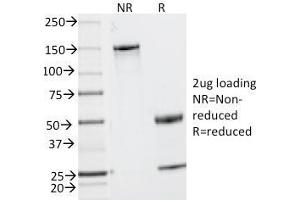 SDS-PAGE Analysis Purified MUC2 Mouse Monoclonal Antibody (MLP/842).