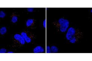 Immunofluorescent staining of Hela cells incubated with MIB Antibody (N-term) (Cat  (ABIN388956 and ABIN2839208)) at a dilution of 1:20. (MIB1 anticorps  (N-Term))