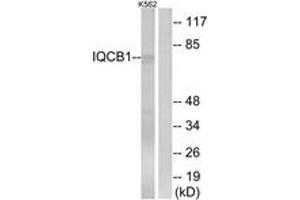 Western Blotting (WB) image for anti-IQ Motif Containing B1 (IQCB1) (AA 431-480) antibody (ABIN2890388) (IQCB1 anticorps  (AA 431-480))