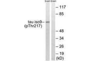 Western blot analysis of extracts from rat brain, using Tau (Phospho-Thr534/217) Antibody. (tau anticorps  (pThr534))