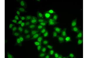 Immunofluorescence analysis of U2OS cells using MAD1L1 antibody. (MAD1L1 anticorps)