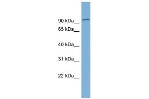FBXO34 antibody used at 1 ug/ml to detect target protein.