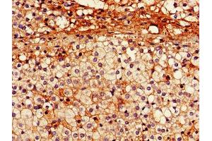 IHC image of ABIN7151093 diluted at 1:600 and staining in paraffin-embedded human adrenal gland tissue performed on a Leica BondTM system. (Parkin anticorps  (AA 1-465))