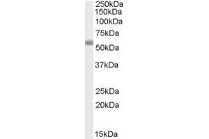 Western Blotting (WB) image for anti-TBC1 Domain Family, Member 10C (TBC1D10C) (AA 405-417) antibody (ABIN303837) (Carabin anticorps  (AA 405-417))