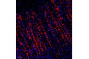 Immunofluorescence of paraffin embedded rat stomach using Treh (ABIN7076006) at dilution of 1:650 (250x lens)