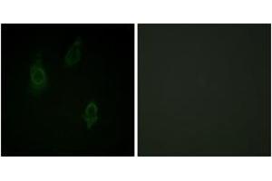 Immunofluorescence analysis of HepG2 cells, using PKC-pan (Phospho-Thr497) Antibody. (PKC anticorps  (pThr497))