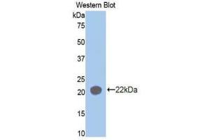 Western Blotting (WB) image for anti-Aminoacyl tRNA Synthetase Complex-Interacting Multifunctional Protein 1 (AIMP1) (AA 148-312) antibody (ABIN1171689) (AIMP1 anticorps  (AA 148-312))