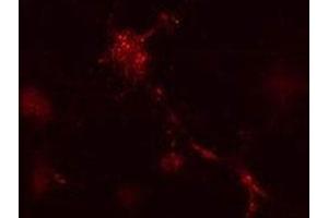 Mouse leukaemic monocyte macrophage cells treated with vinblastine for 1 hr.